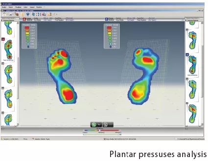 足底压力分析